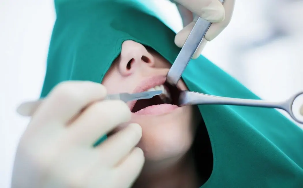 Jak wygląda leczenie zębów pod narkozą w Krakowie?